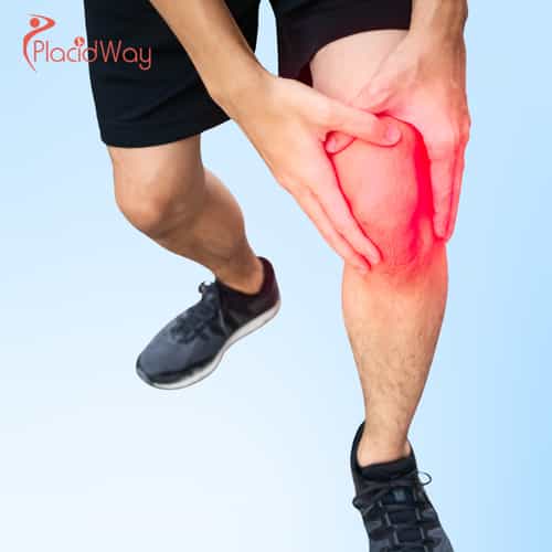 Terapia con células madre para las rodillas en Cancún: Dile adiós al dolor articular.